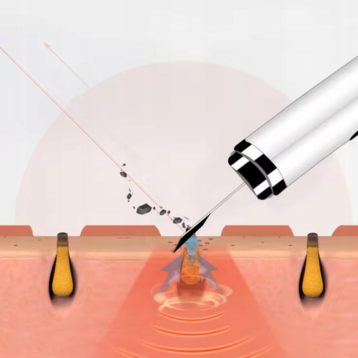 Belaidis veido valymo prietaisas 5in1