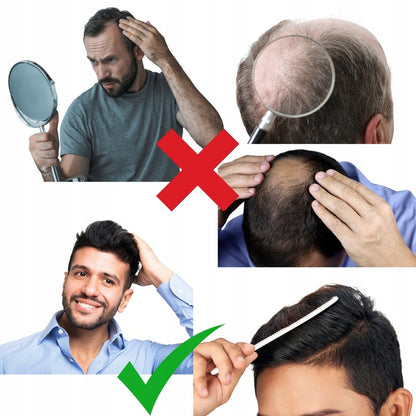 Infraraudonųjų spindulių kepurė plaukų augimui