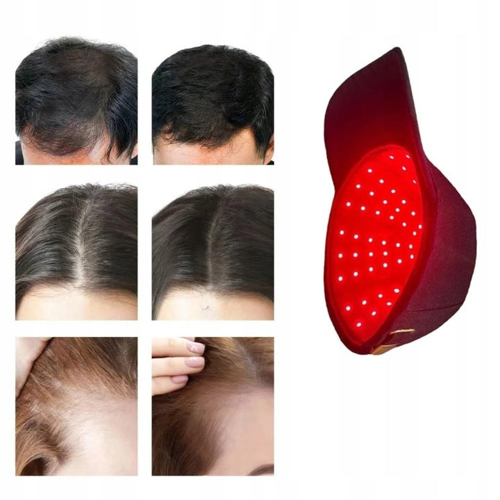 Infraraudonųjų spindulių kepurė plaukų augimui