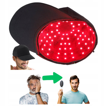 Plaukų augimą skatinanti kepurė su infraraudonųjų spindulių terapija, juodos spalvos, prijungiama USB laidu, naudojama namuose.
